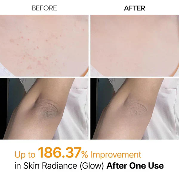 Body Peel Exfoliating Spray