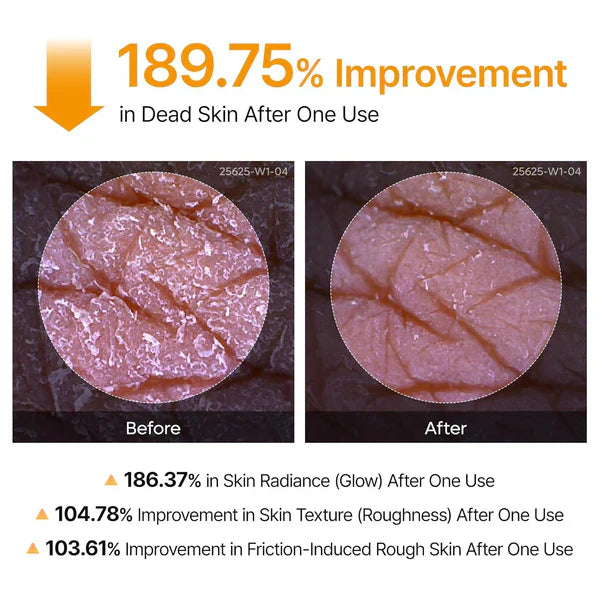 Body Peel Exfoliating Spray