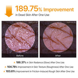 Body Peel Exfoliating Spray