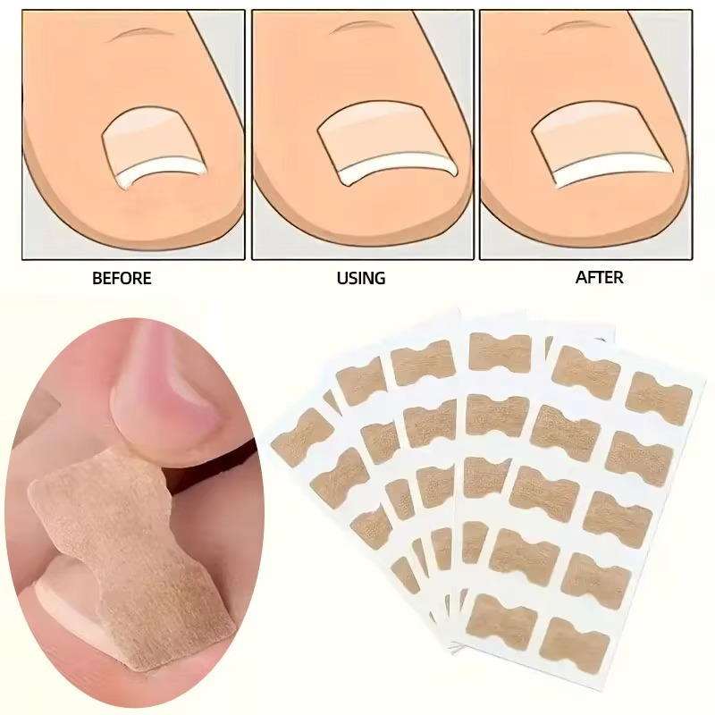 #1 Fungal Nail Patches